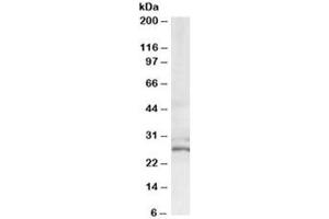Western blot testing of HeLa lysate with TIP30 antibody at 0. (HIV-1 Tat Interactive Protein 2, 30kDa (HTATIP2) antibody)