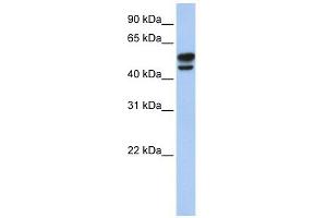 Vimentin antibody used at 1 ug/ml to detect target protein. (Vimentin antibody  (N-Term))