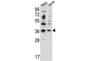 Western blot analysis of PPP1R3G Antibody (C-term) Cat.