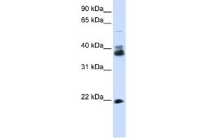 WB Suggested Anti-SYP Antibody Titration:  0. (Synaptophysin antibody  (N-Term))