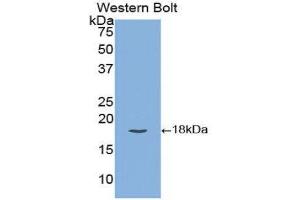 Western Blotting (WB) image for anti-Tissue Factor Pathway Inhibitor (Lipoprotein-Associated Coagulation Inhibitor) (TFPI) (AA 29-210) antibody (ABIN1172818) (TFPI antibody  (AA 29-210))