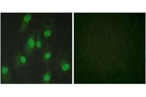 Immunofluorescence analysis of HeLa cells, using Chk1 (Ab-286) Antibody. (CHEK1 antibody  (AA 256-305))
