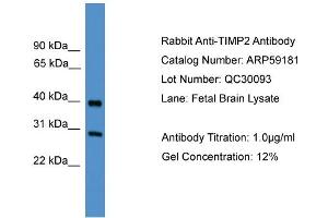 WB Suggested Anti-TIMP2  Antibody Titration: 0.