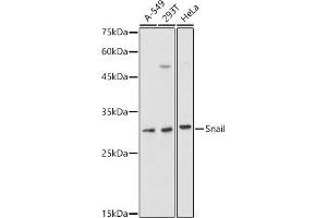 Western blot analysis of extracts of various cell lines, using Snail antibody (ABIN1682836, ABIN3019402, ABIN3019403, ABIN3019404 and ABIN6220883) at 1:1000 dilution. (SNAIL antibody  (AA 1-100))