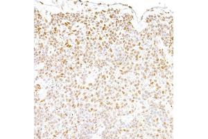 Immunohistochemistry (IHC) image for anti-Fused in Sarcoma (FUS) (AA 400-450) antibody (ABIN7453433) (FUS antibody  (AA 400-450))