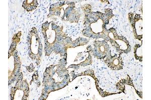 Immunohistochemistry (IHC) image for anti-Keratin 18 (KRT18) (AA 204-430) antibody (ABIN5518769)