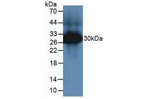 Detection of TPS in Mouse Large Intestine Tissue using Polyclonal Antibody to Tryptase (TPS) (TPSAB1 antibody  (AA 149-273))