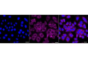 Immunocytochemical staining of HepG2 cells with IGF2BP3 antibody (ABIN7799052), 1:1,000). (Recombinant IGF2BP3 antibody)