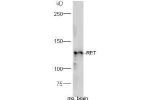 Mouse brain lysates probed with Rabbit Anti-RET Polyclonal Antibody, Unconjugated (ABIN2559573) at 1:300 in 4˚C. (Ret Proto-Oncogene antibody  (AA 501-600))