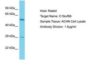 Image no. 1 for anti-Chromosome 19 Open Reading Frame 66 (C19ORF66) (AA 35-84) antibody (ABIN6750629) (C19ORF66 antibody  (AA 35-84))
