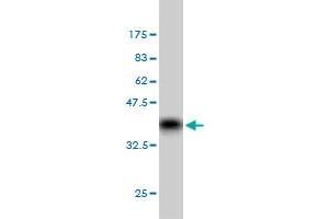 Western Blot detection against Immunogen (36. (GRK6 antibody  (AA 71-170))