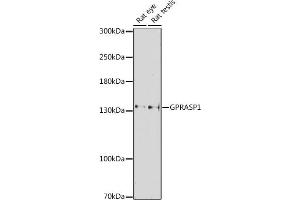 Western blot analysis of extracts of various cell lines, using GPR antibody (ABIN7267314) at 1:1000 dilution. (GPRASP1 antibody  (AA 200-500))