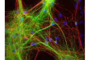 Mixed neuron and glia cultures stained with ABIN1580433 (green), and RPCA- NF-H rabbit antibody to neurofilament NF-H (red) and DNA (blue). (MAP2 antibody)
