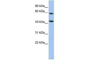 WB Suggested Anti-FOXJ3 Antibody Titration:  0. (FOXJ3 antibody  (Middle Region))