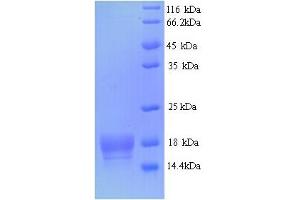 SDS-PAGE (SDS) image for ATP Synthase gamma Chain 1 (ATPC1) (AA 23-168) protein (His tag) (ABIN5713270)