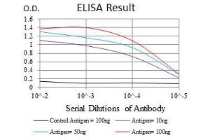 Black line: Control Antigen (100 ng), Purple line: Antigen(10 ng), Blue line: Antigen (50 ng), Red line: Antigen (100 ng), (BPIFB1 antibody)