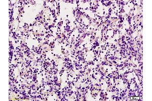 Formalin-fixed and paraffin embedded rat lung labeled with Anti-TRAIL Polyclonal Antibody, Unconjugated (ABIN673494) at 1:200 followed by conjugation to the secondary antibody and DAB staining. (TRAIL antibody  (AA 185-281))