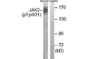 Immunohistochemistry analysis of paraffin-embedded human brain tissue using JAK2 (Phospho-Tyr931) antibody. (JAK2 antibody  (pTyr931))