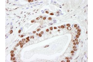 Immunohistochemistry (IHC) image for anti-Protein Kinase, DNA-Activated, Catalytic Polypeptide (PRKDC) (AA 2100-2150) antibody (ABIN7448533)