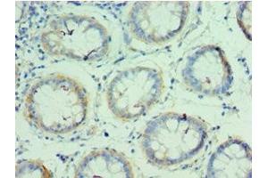 Immunohistochemistry (IHC) image for anti-Glutaminyl-tRNA Synthetase (QARS) (AA 1-250) antibody (ABIN7154026)