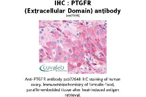 Image no. 1 for anti-Prostaglandin F Receptor (FP) (PTGFR) (1st Extracellular Domain) antibody (ABIN1738570) (PTGFR antibody  (1st Extracellular Domain))