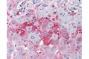 Immunohistochemical (Formalin/PFA-fixed paraffin-embedded sections) staining in human liver with DUSP26 polyclonal antibody . (DUSP26 antibody)