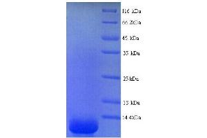 SDS-PAGE (SDS) image for Dermcidin (DCD) (AA 20-110) protein (His tag) (ABIN4976040) (Dermcidin Protein (DCD) (AA 20-110) (His tag))
