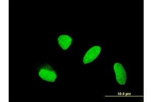 Immunofluorescence of monoclonal antibody to KLHDC4 on HeLa cell. (KLHDC4 antibody  (AA 1-463))