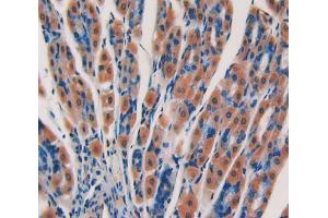 Used in DAB staining on fromalin fixed paraffin- embedded stomach tissue (CYP24A1 antibody  (AA 260-514))