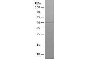 Western Blotting (WB) image for Organic Anion Transporter H (OATP-H) (AA 1-101) protein (His-IF2DI Tag) (ABIN7282531) (SLCO4C1 Protein (AA 1-101) (His-IF2DI Tag))