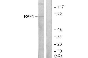 Western blot analysis of extracts from HT-29 cells, using Raf1 (Ab-341) antibody. (RAF1 antibody  (Tyr341))