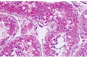 Human, Testis: Formalin-Fixed Paraffin-Embedded (FFPE) (SMO antibody  (1st Extracellular Domain))