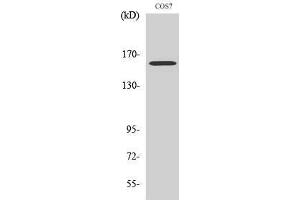 Western Blotting (WB) image for anti-RAB3 GTPase Activating Protein Subunit 2 (Non-Catalytic) (RAB3GAP2) (Internal Region) antibody (ABIN3186620)