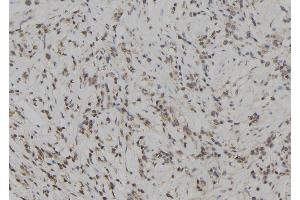 ABIN6272929 at 1/100 staining Human gastric tissue by IHC-P. (SKAP2 antibody  (C-Term))