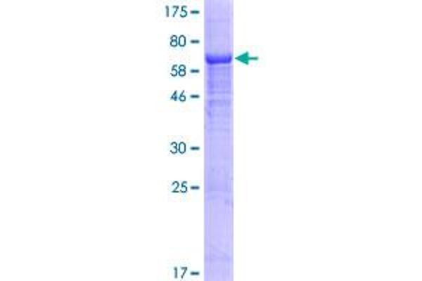 IFI44L Protein (AA 1-413) (GST tag)