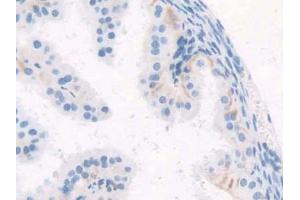 IHC-P analysis of Mouse Oviduct Tissue, with DAB staining. (WISP1 antibody  (AA 213-350))
