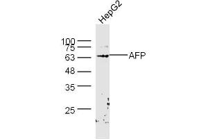 HepG2 lysates probed with AFP Polyclonal Antibody, Unconjugated  at 1:300 dilution and 4˚C overnight incubation. (alpha Fetoprotein antibody  (AA 501-609))