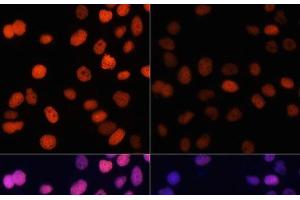 Immunofluorescence analysis of HeLa cells using Acetyl-Histone H4-K91 Polyclonal Antibody at dilution of 1:100. (Histone H4 antibody  (acLys91))