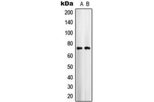 Western blot analysis of ARALAR1 expression in COLO205 (A), U251MG (B) whole cell lysates. (SLC25A12 antibody  (Center))