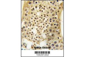 Formalin-fixed and paraffin-embedded human testis tissue reacted with USP7 antibody , which was peroxidase-conjugated to the secondary antibody, followed by DAB staining. (USP7 antibody  (C-Term))