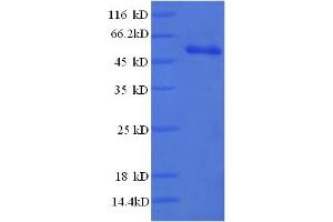 SDS-PAGE (SDS) image for CD3 epsilon (CD3E) (AA 23-207) protein (GST tag) (ABIN5712734) (CD3 epsilon Protein (CD3E) (AA 23-207) (GST tag))