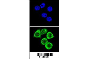 Confocal immunofluorescent analysis of PARP1 Antibody with Hela cell followed by Alexa Fluor 488-conjugated goat anti-rabbit lgG (green). (PARP1 antibody  (N-Term))