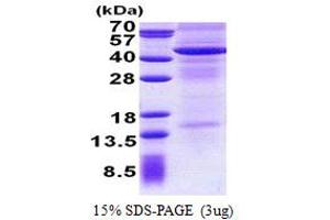 SDS-PAGE (SDS) image for Interleukin 13 Receptor, alpha 2 (IL13RA2) (AA 27-343) protein (His tag) (ABIN5853014)