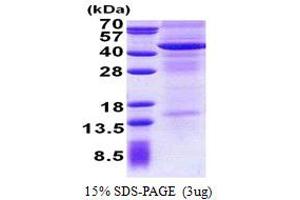 SDS-PAGE (SDS) image for Interleukin 13 Receptor, alpha 2 (IL13RA2) (AA 27-343) protein (His tag) (ABIN5853014) (IL13RA2 Protein (AA 27-343) (His tag))