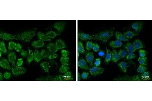 ICC/IF Image CLPP antibody [C2C3], C-term detects CLPP protein at mitochondria by immunofluorescent analysis. (CLPP antibody  (C-Term))