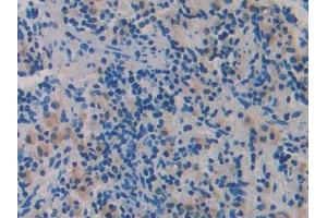 Used in DAB staining on fromalin fixed paraffin- embedded adrenal gland tissue (ADAMTS1 antibody  (AA 854-967))