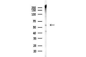 anti-Solute Carrier Family 2 (Facilitated Glucose Transporter), Member 3 (SLC2A3) (C-Term) antibody