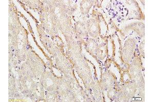 Formalin-fixed and paraffin embedded mouse kidney labeled with Rabbit Anti-APG5L/ATG5 Polyclonal Antibody  at 1:100 followed by conjugation to the secondary antibody and DAB staining. (ATG5 antibody  (AA 101-200))