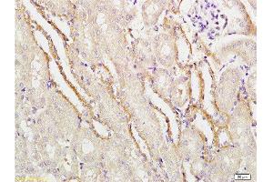 Formalin-fixed and paraffin embedded mouse kidney labeled with Rabbit Anti-APG5L/ATG5 Polyclonal Antibody  at 1:100 followed by conjugation to the secondary antibody and DAB staining. (ATG5 antibody  (AA 101-200))