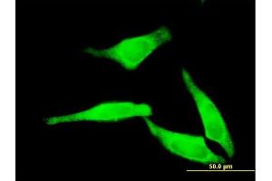 Immunofluorescence of monoclonal antibody to NT5C2 on HeLa cell. (NT5C2 antibody  (AA 1-561))